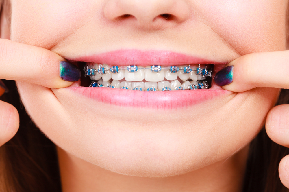 Odontología ortodoncia