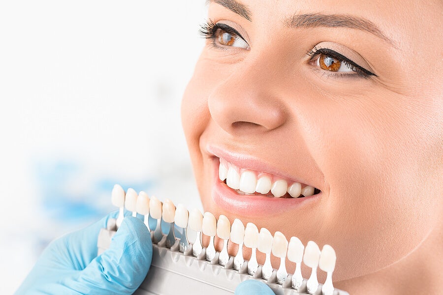 blanqueamiento dental tratamiento estético