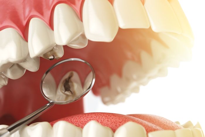 empastes dentales