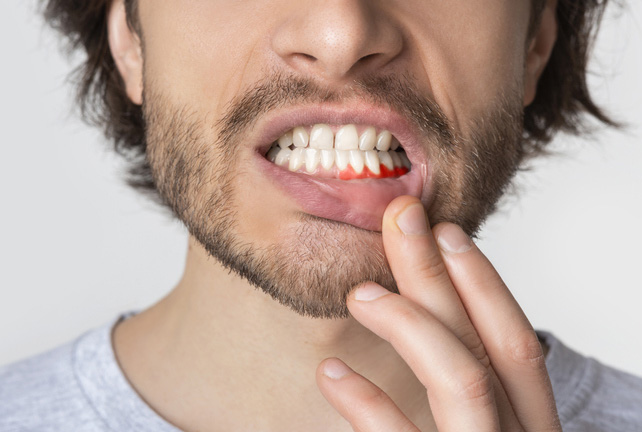 periodoncia portada